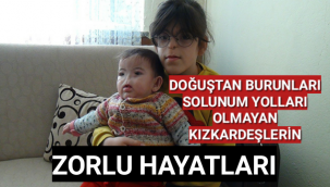 İki Kız Kardeş Milyonda Bir Görülen Hastalıkla Mücadele Ediyor