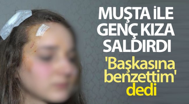 Genç kız, tanımadığı kişi tarafından sokak ortasında 'Muşta' ile darp edildi