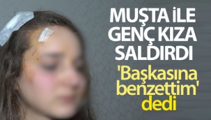 Genç kız, tanımadığı kişi tarafından sokak ortasında 'Muşta' ile darp edildi