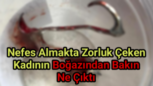 Nefes almakta zorluk çeken kadının boğazından bakın ne çıktı