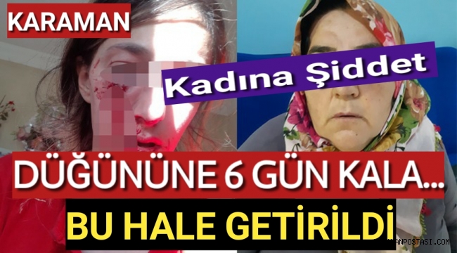 KADINA ŞİDDET...DÜĞÜNÜNE 6 GÜN KALA BU HALE GETİRİLDİ