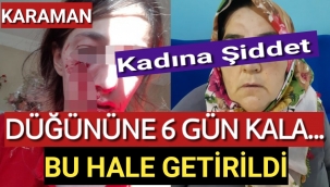 KADINA ŞİDDET...DÜĞÜNÜNE 6 GÜN KALA BU HALE GETİRİLDİ
