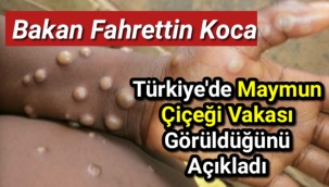 Sağlık Bakanı Fahrettin Koca, Türkiye'de maymun çiçeği vakası görüldüğünü açıkladı.