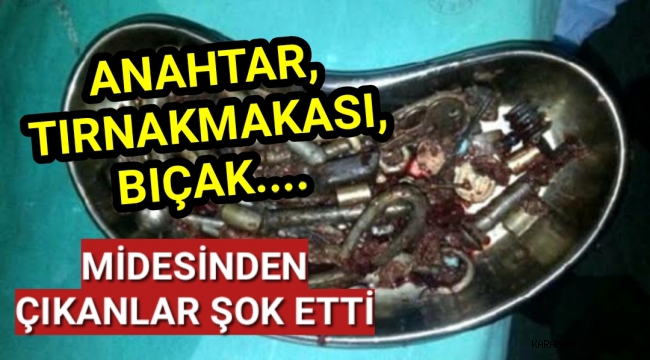 Midesinde 158 parça metal çıktı