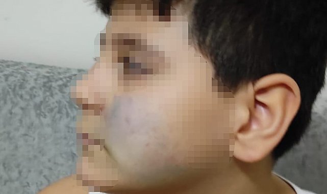 Başkent'te akran şiddeti iddiası