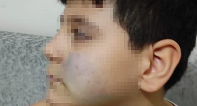 Başkent'te akran şiddeti iddiası