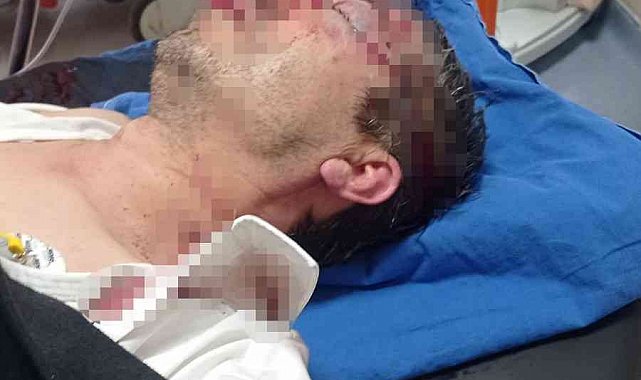 Sivas Ziraat Odası Sekreteri'ne saldırı