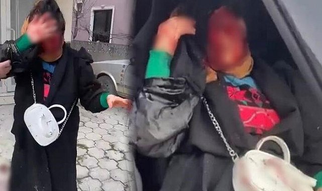 Sakarya'da korkunç olay! Sokak ortasında dehşeti yaşadı, kanlar içinde kaldı