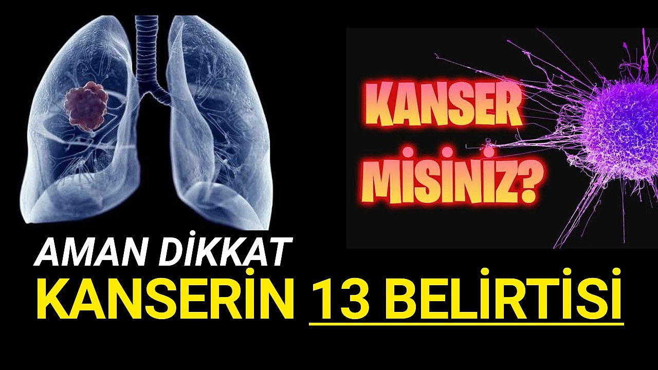 Bu Belirtiler Varmı ?