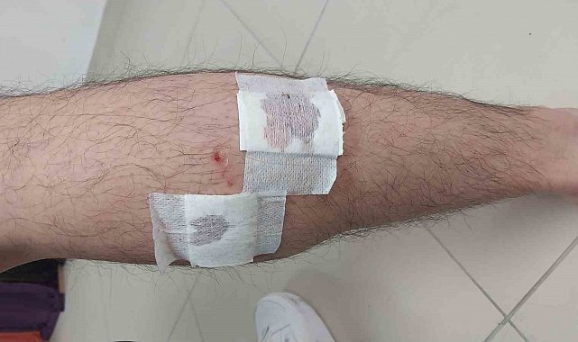Mersin'de sokak köpekleri belediye çalışanına saldırıp ısırdı