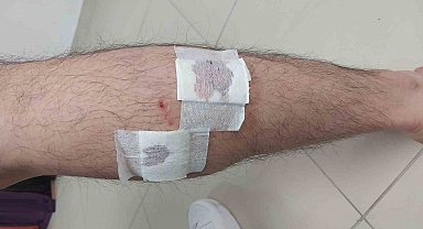 Mersin'de sokak köpekleri belediye çalışanına saldırıp ısırdı