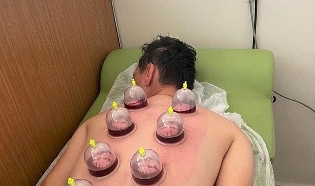 O hastanede hacamat ve akupunktur tedavisi başladı