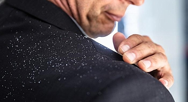 Saç kepeği diyerek görmezden gelmeyin! Kafa derisinde görülen bu durum o hastalığın habercisi olabilir