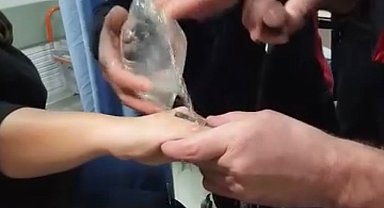 Elazığ'da parmağa sıkışan yüzüğü itfaiye ekipleri çıkardı