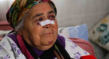 Otomobilin çarptığı yaşlı kadın: "Gözümün içine bakıp kaçtı"