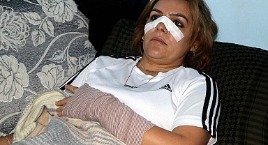 Başkanın yakınları öldüresiye dövdü! Roman kadına ‘koordinatör oldun’ dayağı