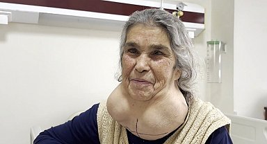 Doktordan korktuğu için yıllarca devasa kitleyle yaşadı