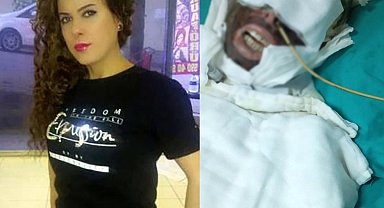 Kimyasalla yaktığı kadını yatağa mahkum eden sanık hakkında mütalaa: 20 yıla kadar hapisle cezalandırılması talep edildi