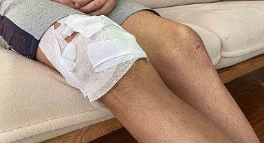 Köpek saldırısına uğrayan çocuğun ailesi, Çankaya Belediyesine dava açmaya hazırlanıyor