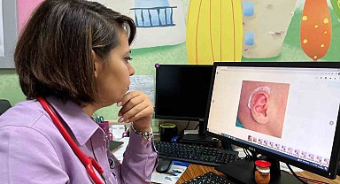 Kulaktaki şekil bozukluklarına ameliyatsız çözüm