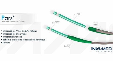 PARS Kateter, cerrahi müdahalelerde doktorların hassasiyetle yönlendirmelerini mümkün kılacak