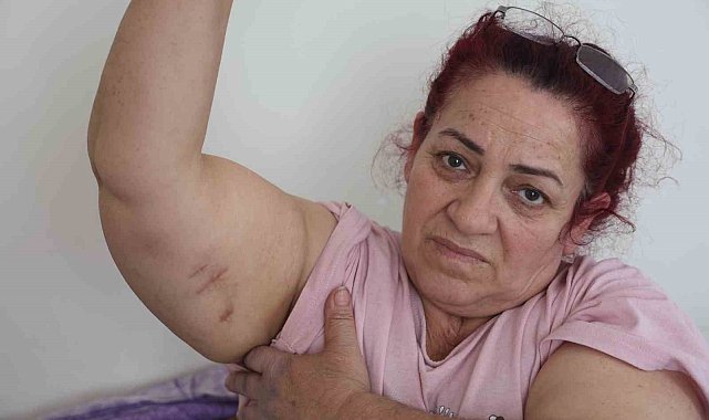 Köpeklerin saldırısına uğrayan kadın: "Ben o an öldüğümü sandım"