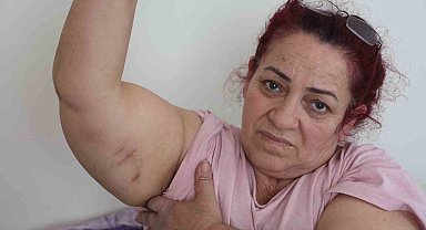 Köpeklerin saldırısına uğrayan kadın: "Ben o an öldüğümü sandım"