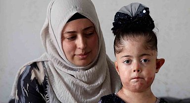 Tek dileği kelebek hastası kızına doyasıya sarılabilmek