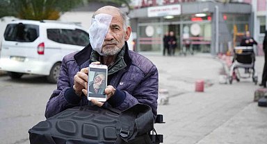 Yüzü eriyen adam tedavi olmak istiyor