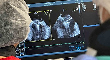 Denizli'de ilk defa ameliyatsız mitral kapak yetmezliği tamiri yapıldı