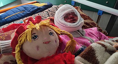 İsrail'in saldırılarında yüzü yanan 4 yaşındaki Seca, tedavi için bekliyor