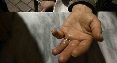 Parmağına yüzük sıkışan sahsa itfaiye ekiplerinden müdahale