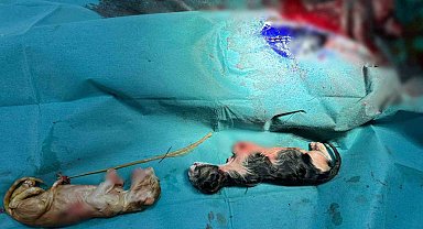 Normalinden 2 kat büyük 3 kedi yavrusu sezaryen ile alındı