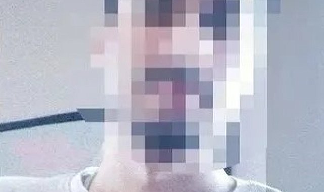 Yoğun bakım sapığına "iyi hal" indirimine başsavcılıktan itiraz