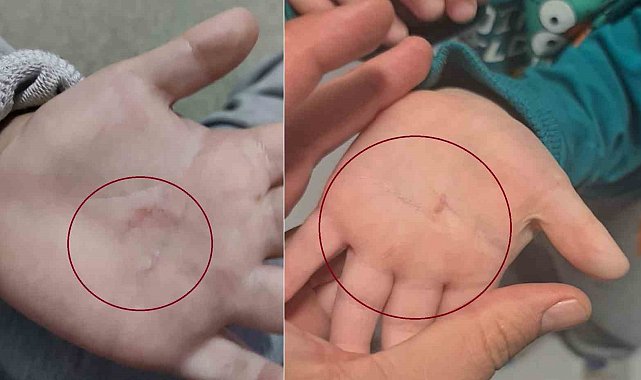 Bandırma Belediyesi'nin kreşinde 4 yaşındaki çocuğa şiddet iddiası