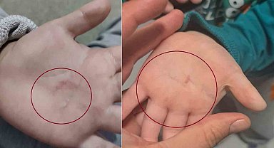 Bandırma Belediyesi'nin kreşinde 4 yaşındaki çocuğa şiddet iddiası