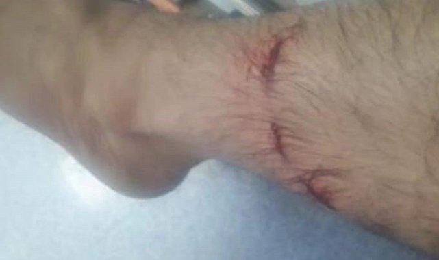 Başıboş köpeklerin saldırısına uğradı