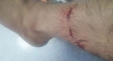 Başıboş köpeklerin saldırısına uğradı