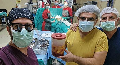 Kalpten beslenerek çevresini tamamen saran 1,1 kilogram yağ kitlesi görenleri hayrete düşürdü