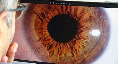 "İris" fotoğrafçılığı ilgi görüyor