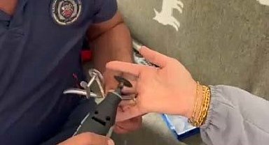 Sıkışan yüzük itfaiye ekipleri tarafından çıkarıldı