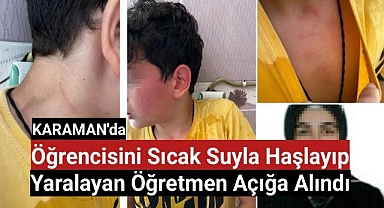 Karaman'da Öğrencisini sıcak suyla haşlayıp yaralayan öğretmen açığa alındı