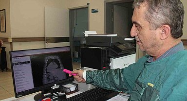 Dünyada ilk kez görülen "Giresun Sendromu" tıp literatürüne girdi