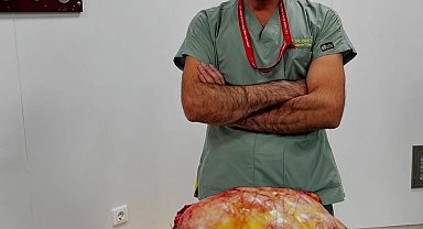 Karın ağrısı şikayeti ile gelen hastanın karnından 26 kilogramlık tümör çıktı