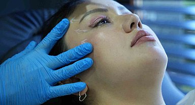 Son zamanların estetik trendi: 'Tilki göz' ameliyatları