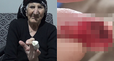 Herkesin başına gelebilir! MR'a giren kadın kabusu yaşadı! Uzvunu kaybetme tehlikesiyle karşı karşıya...