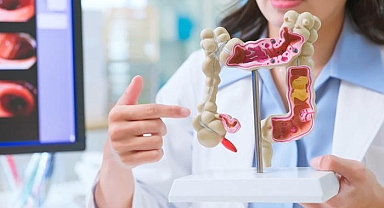 Bu hastalığın ölüm riski çok yüksek… Kolon kanserinden korunmak için neler yapılmalıdır?