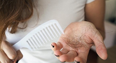 Saç ekiminin psikolojik etkisi: 'Kel' denildiği için boşanan da var, işe giremeyen de