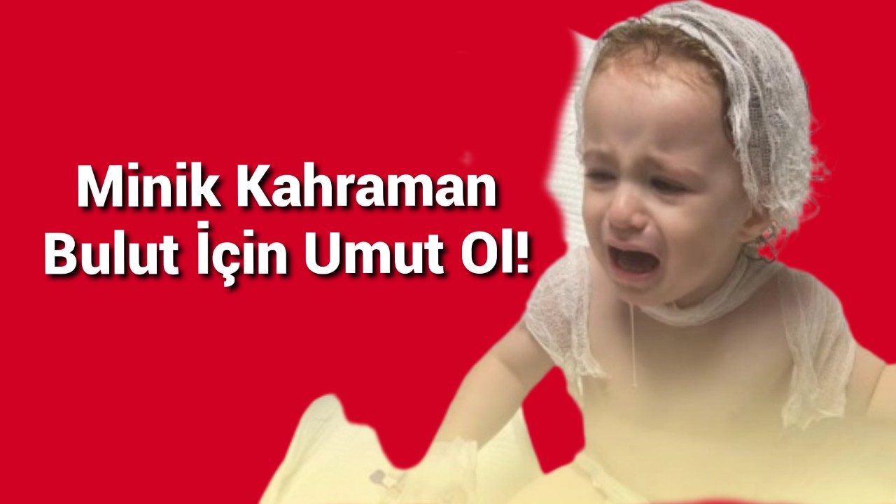 Minik kahraman bulut için umut ol!