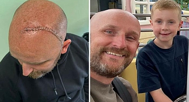 Baş dönmesi ile hastaneye gitti: 6 yıl ömrün kaldı dediler! Gerçek teşhis sonradan ortaya çıktı!